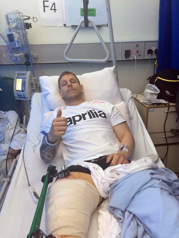 BREAKING BAD: Ben Wilson remains in high spirits despite suffering a compound fracture of his femur at the NW 200.